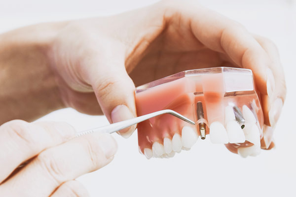 Experience the Best of Turkey